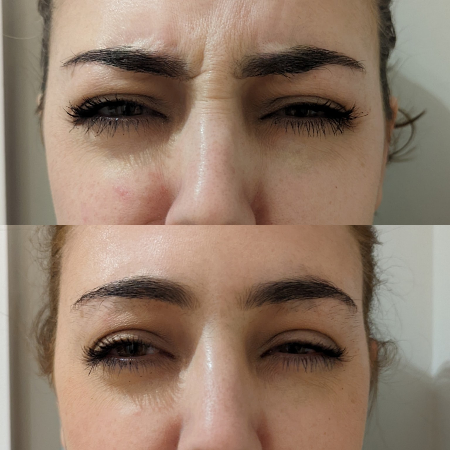 Before and After 1