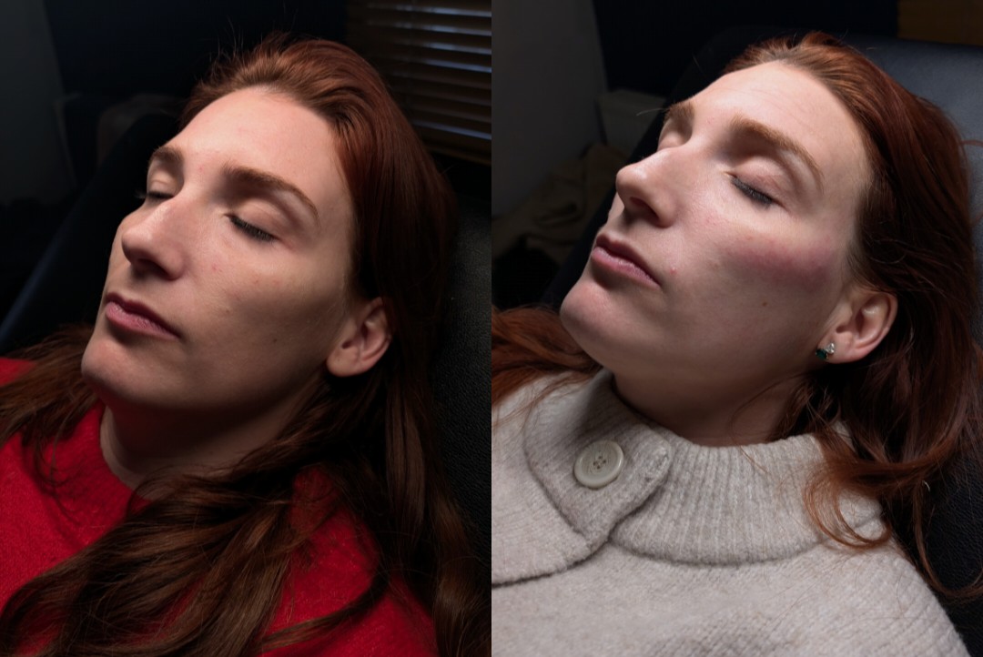 Before and After 10