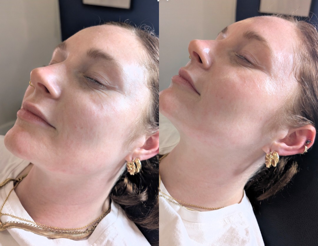 Before and After 12