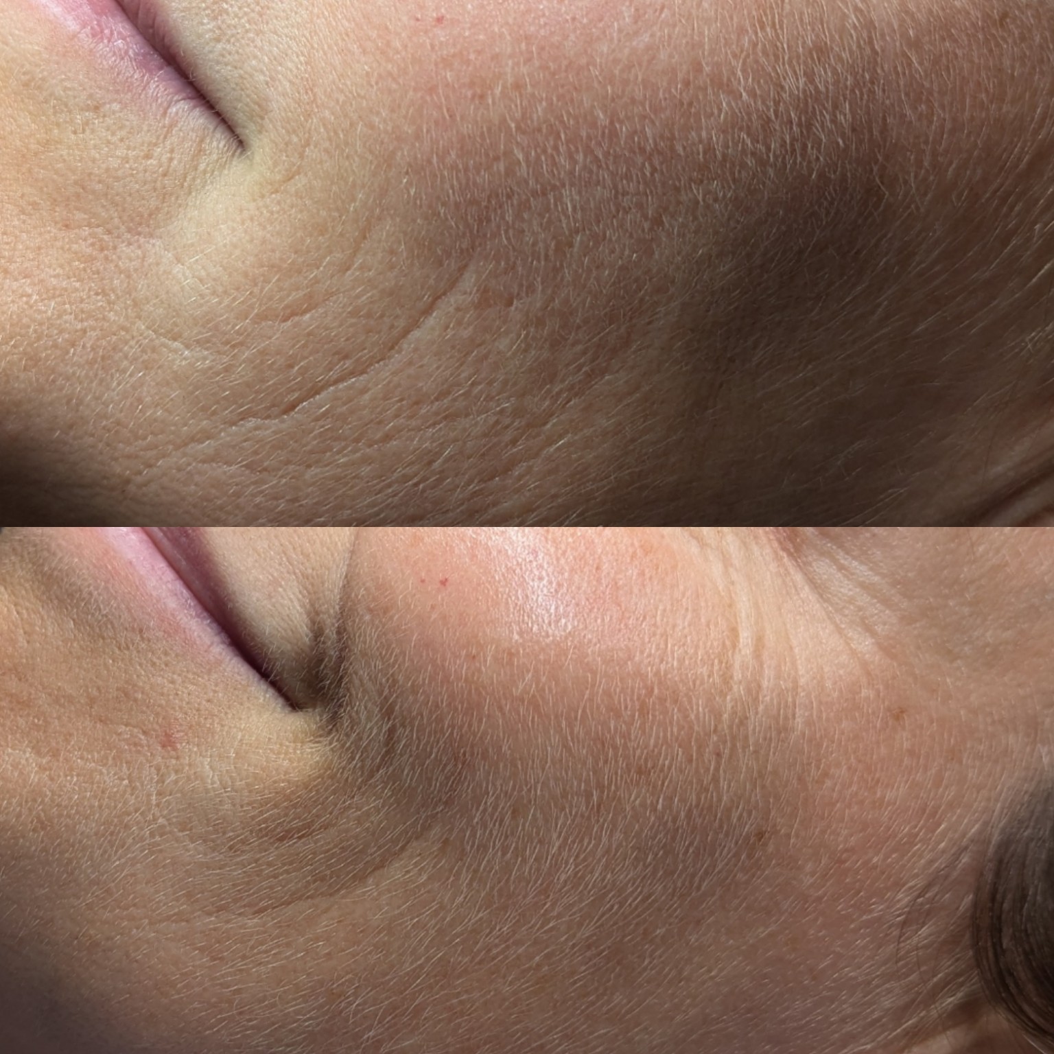 Before and After 2