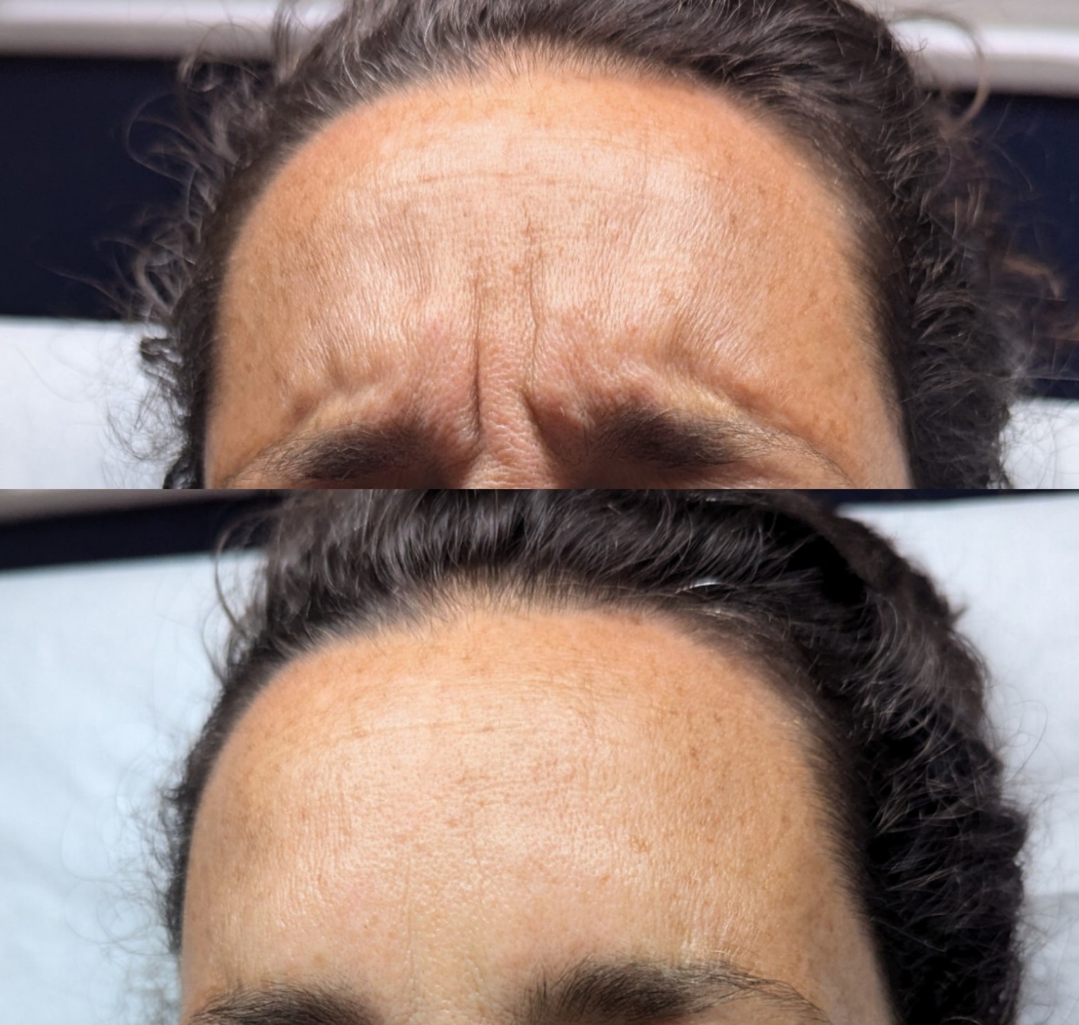 Before and After 3