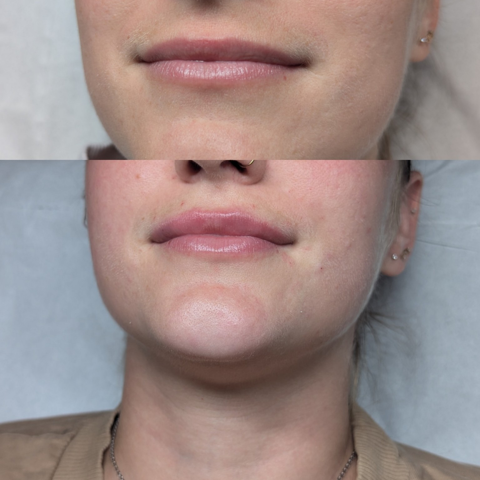 Before and After 4