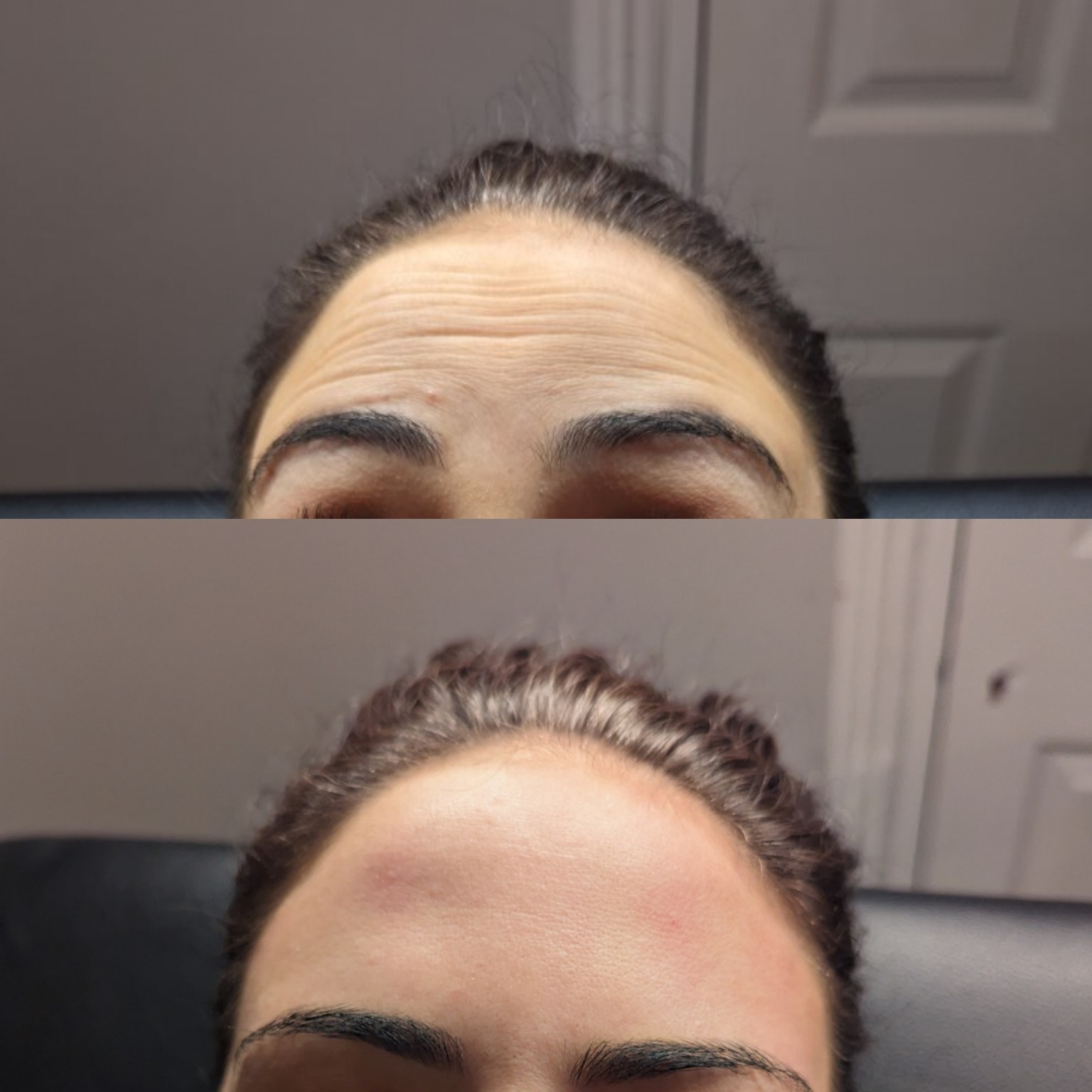 Before and After 5