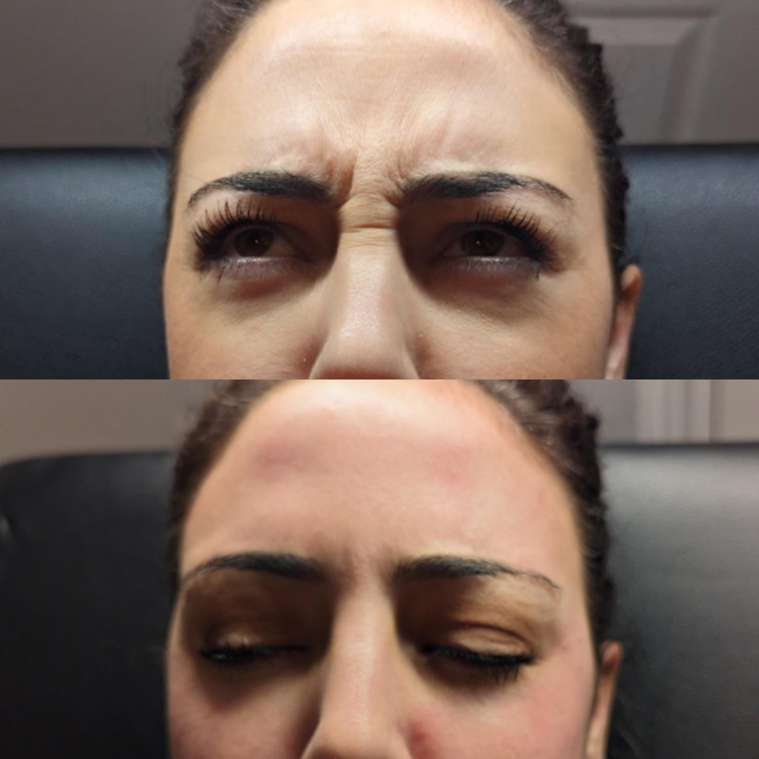 Before and After 6