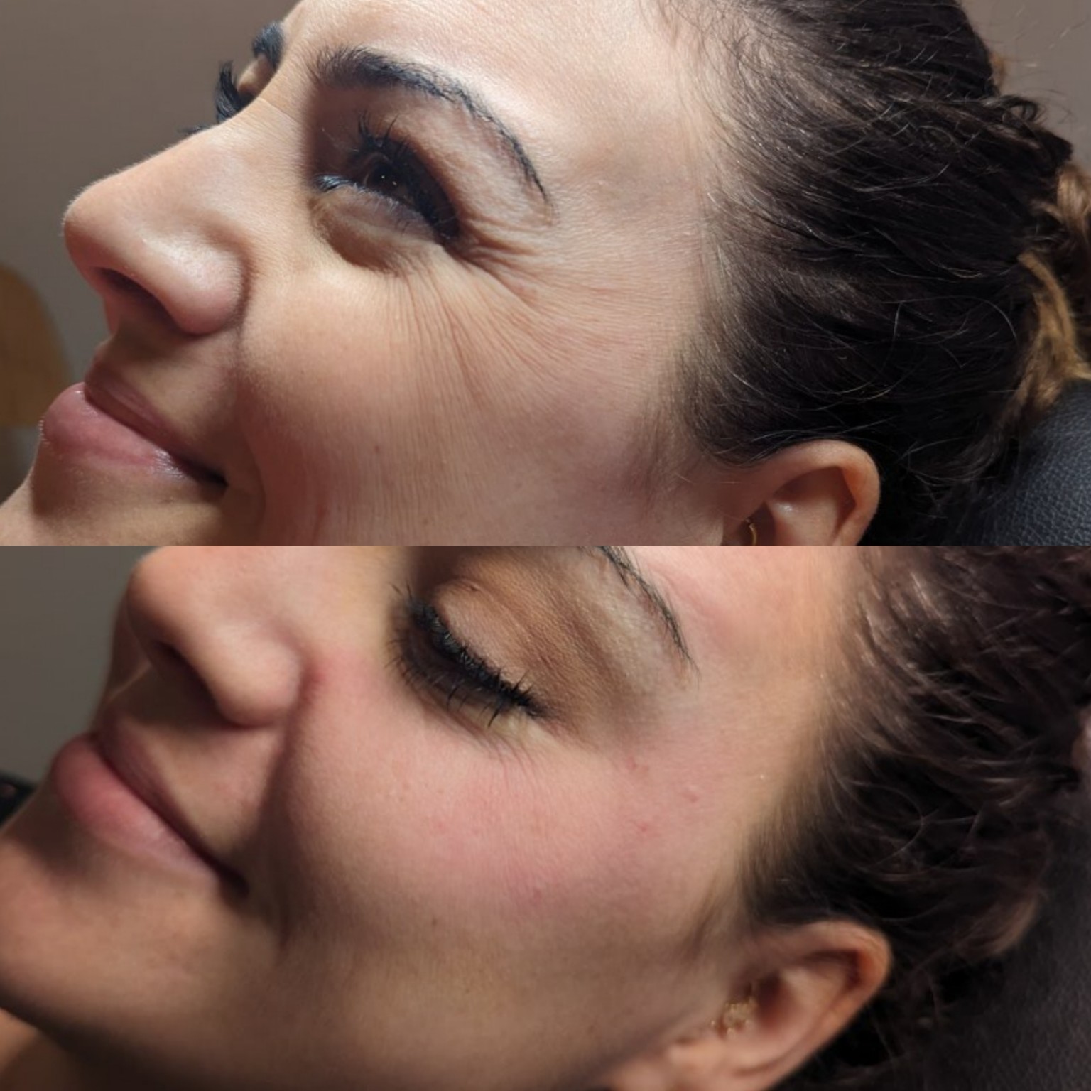 Before and After 7