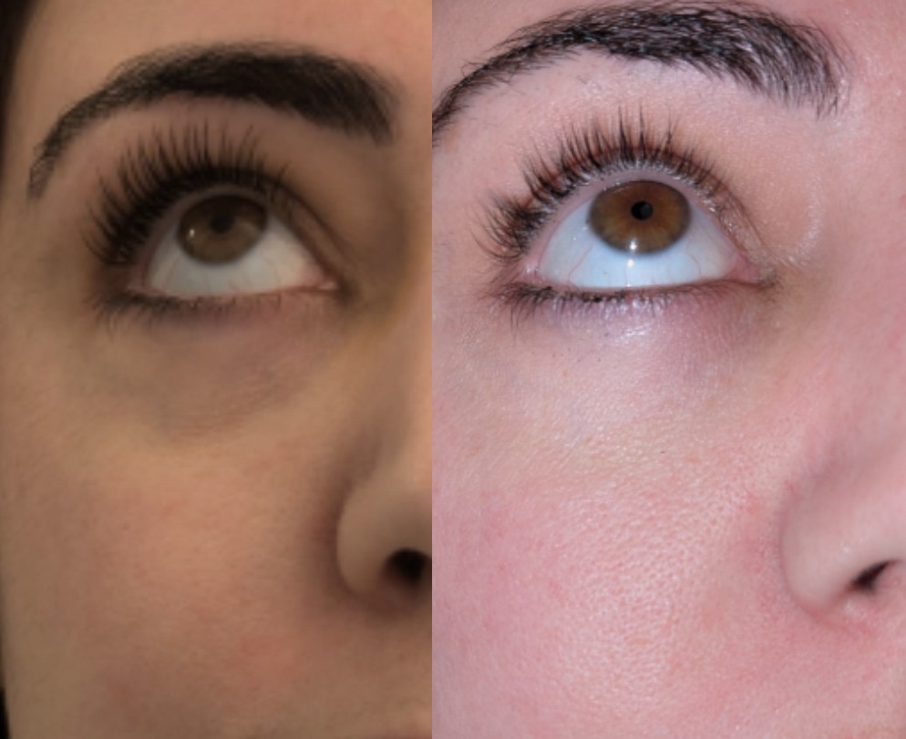 Before and After 8