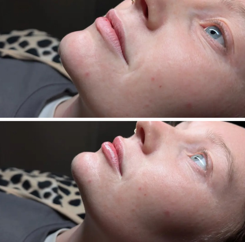 Before and After 9